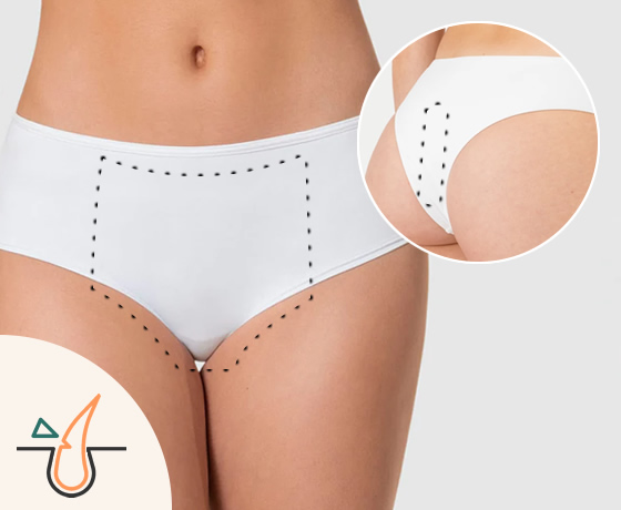s_17_depilacion_bikini_brsileno2